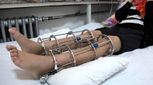 شما هم می‌خواهید قد بلندی داشته باشید؟/ معجزه قرن یا شکنجه قرن؟!

