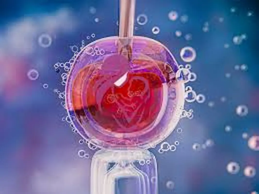 از عوارض IVF خبر دارید؟ 