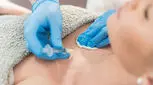 تزریق فیلر سینه، هرچه لازم است بدانید را این‌جا بخوانید!