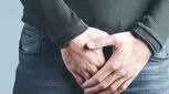 بهترین دکتر واریکوسل در تهران را بشناسید + لیست 10 دکتر برتر 