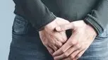 بهترین دکتر واریکوسل در تهران را بشناسید + لیست 10 دکتر برتر 