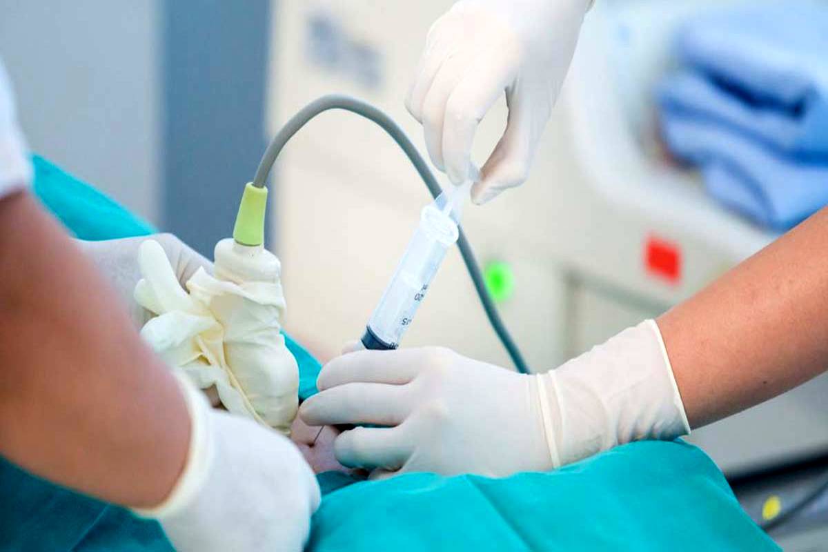 علت انجام آمنیوسنتز، چیست؟