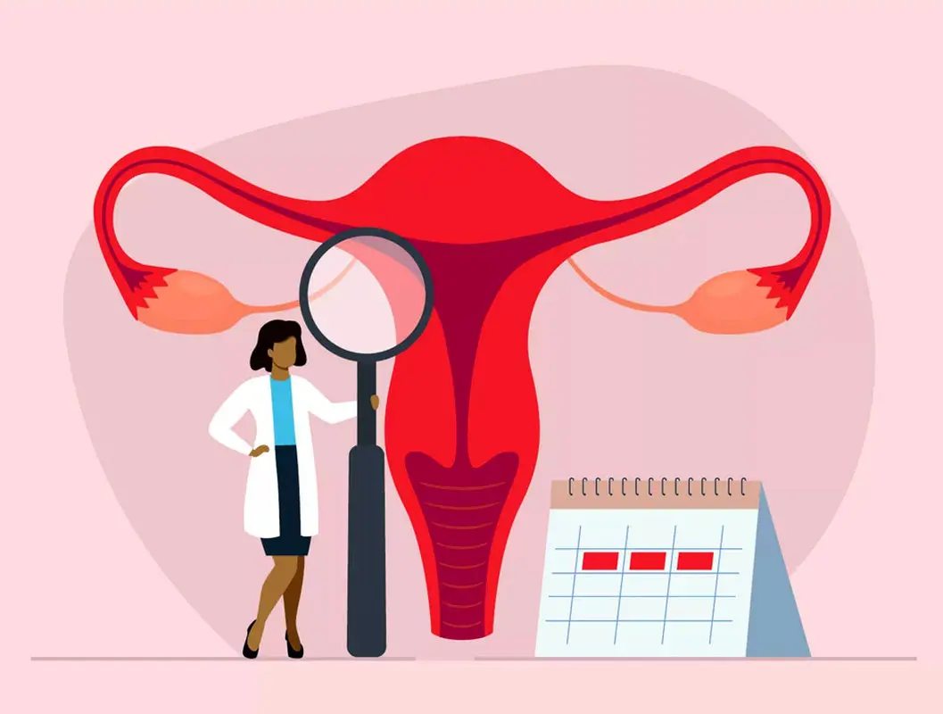 پریود دو بار در ماه و تفاوت‌های آن با خونریزی غیر طبیعی