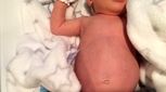 بزرگ بودن شکم نوزاد، مسئله مهمی است؟