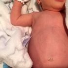 بزرگ بودن شکم نوزاد، مسئله مهمی است؟