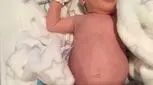 بزرگ بودن شکم نوزاد، مسئله مهمی است؟