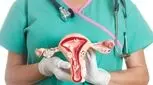 سرطان دهانه رحم تا ۹۰ درصد قابل پیشگیری است