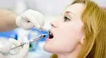 با بی‌حسی لب بعد از دندانپزشکی چه کنیم؟