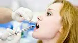 با بی‌حسی لب بعد از دندانپزشکی چه کنیم؟