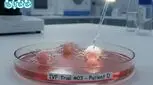 ای وی اف (IVF) چیست و چگونه انجام می‌شود؟