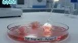 ای وی اف (IVF) چیست و چگونه انجام می‌شود؟