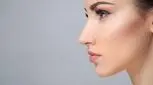 مراقبت‌های بعد از لیفت ابرو با نخ
