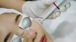 درمان جای جوش صورت با لیزر، بهبودی در کمترین زمان