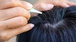 فرضیه بیشتر شدن موهای سفید با کندن چقدر درست است؟

 