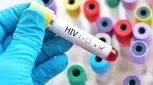  پاسخ‌های سرراست و علمی درباره ویروس HPV که باید بدانید