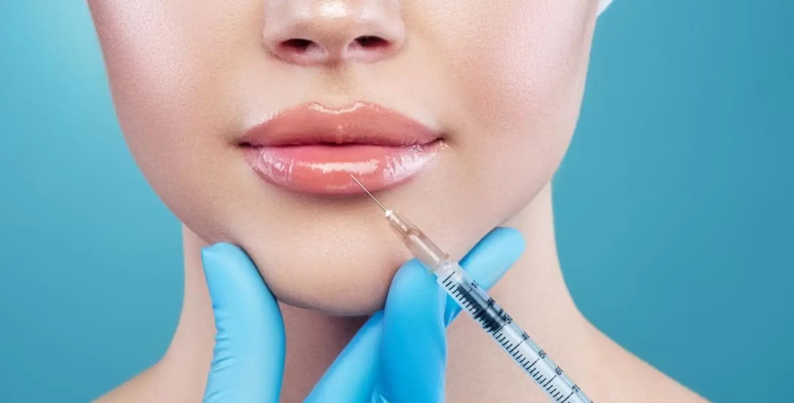 بهترین دکتر تزریق ژل لب روسی، هر آنچه نیاز است بدانید 