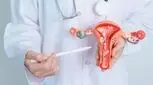درمان انسداد لوله های رحم، جراحی لازم است؟