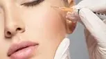 ژل الانسه چیست و چه کاربردی دارد؟
