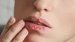 چند راهکار برای پیشگیری از خشکی و ترک لب‌ها در رمضان