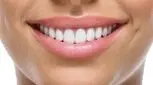 تفاوت قیمت لمینت و کامپوزیت دندان چقدر است؟