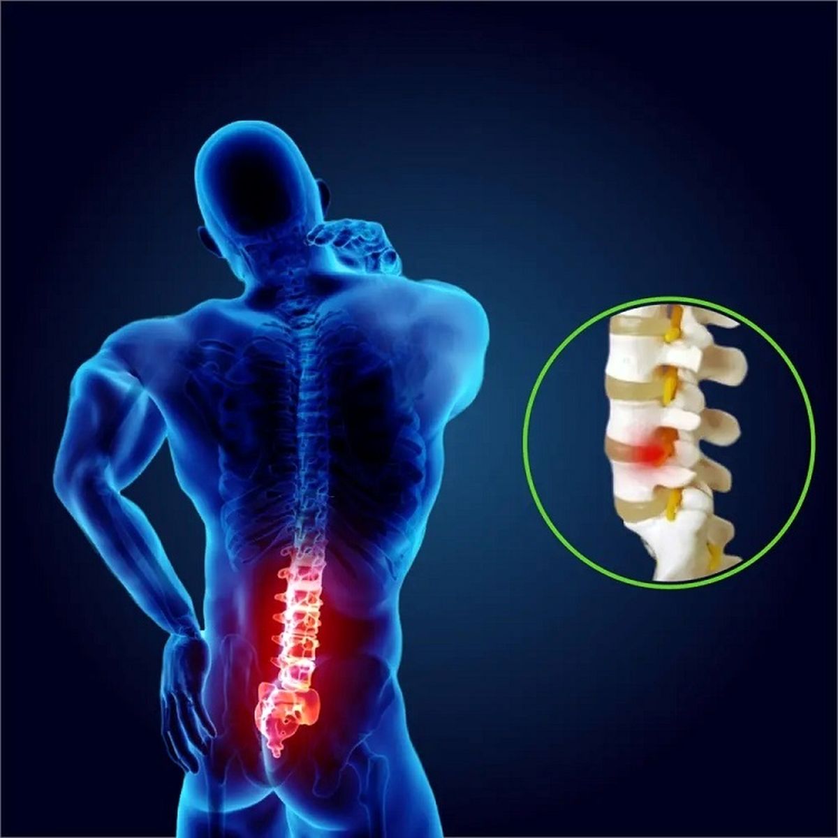 تنگی کانال نخاع، همه خانم ها دچار می شوند؟