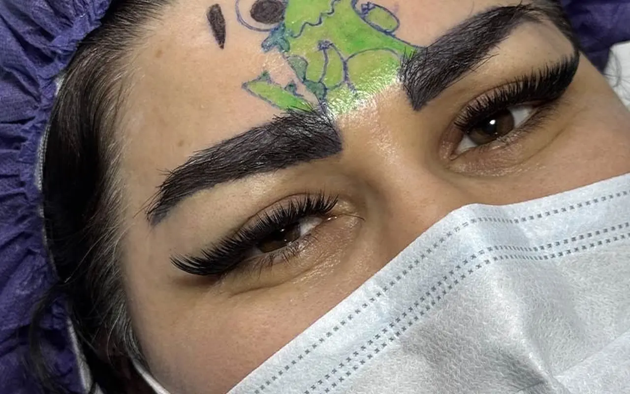 بهترین روش از بین بردن پف ابرو