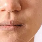 چرا با وجود استفاده از کرم، پوستمان خشک می‌شود؟