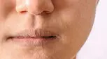 چرا با وجود استفاده از کرم، پوستمان خشک می‌شود؟