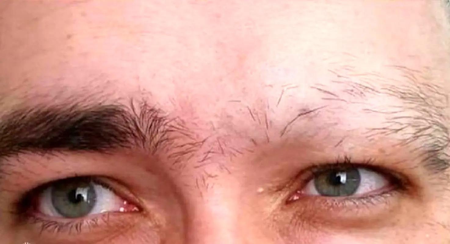 خبر خوب برای کسانی که ریزش ابرو دارند