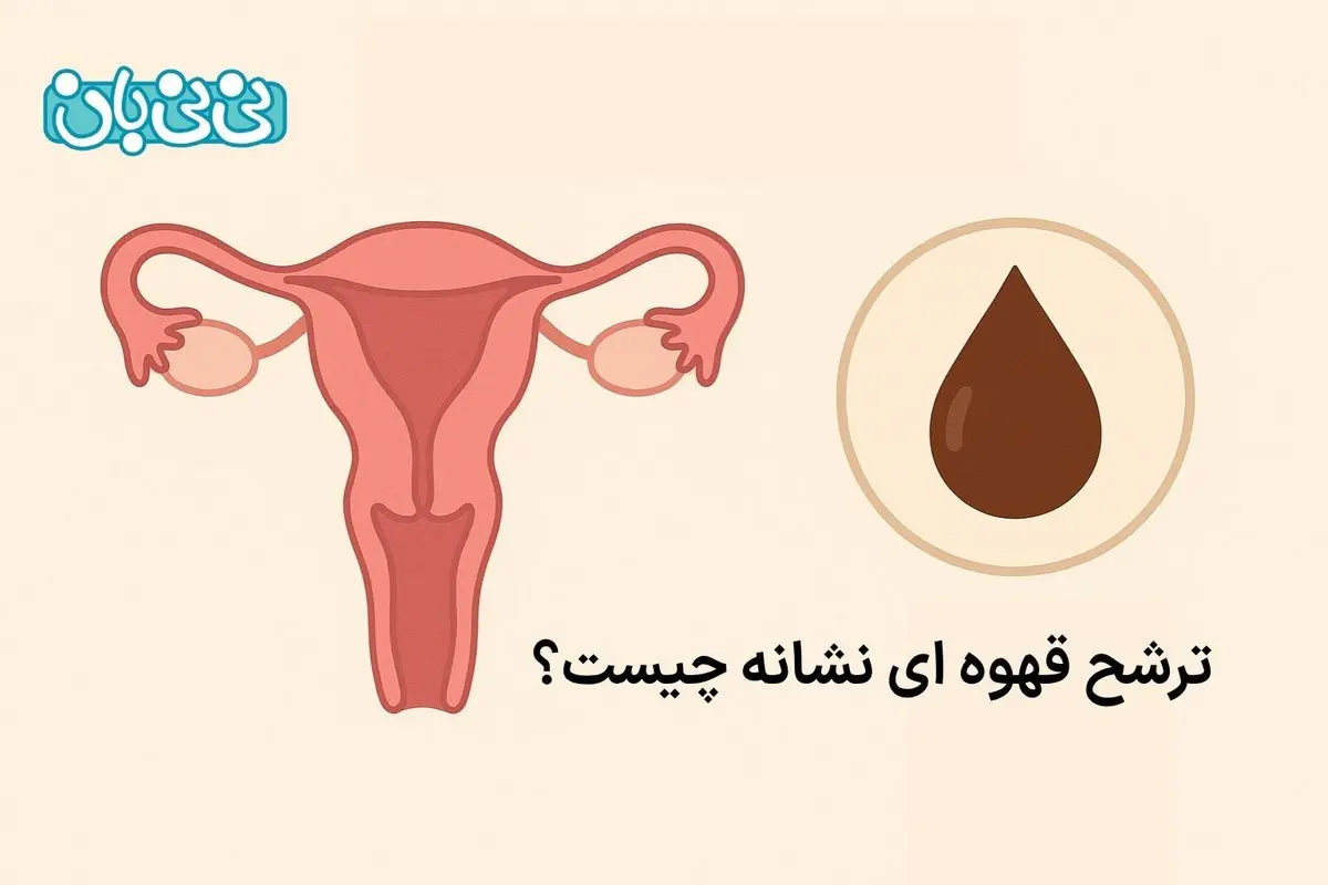 ترشحات قهوه ای واژن نشانه چیست؟ ۳ علت و روشهای درمان