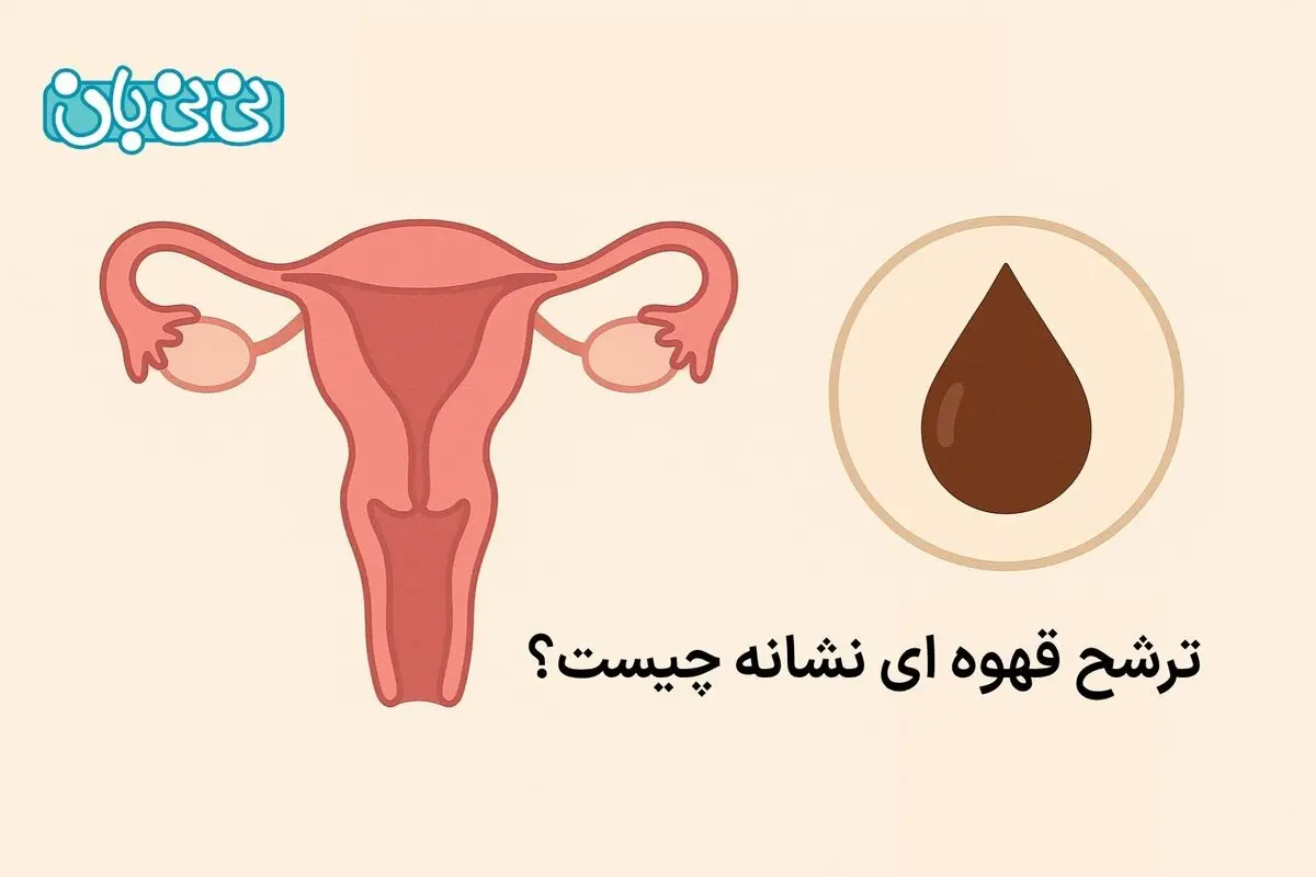 ترشحات قهوه ای واژن نشانه چیست؟ ۳ علت و روش‎‌های درمان