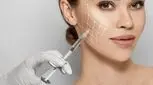 قیمت انواع بوتاکس سال 1403 ، راهنمایی‌هایی برای انتخاب بهتر