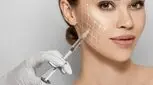 قیمت انواع بوتاکس سال 1403 ، راهنمایی‌هایی برای انتخاب بهتر
