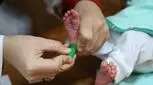 کم‌کاری تیروئید، بیماری خاموش اما خطرناک در نوزادان