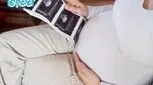 پرسنتایل وزن جنین _ جدول صدک وزن جنین بر اساس هفته بارداری