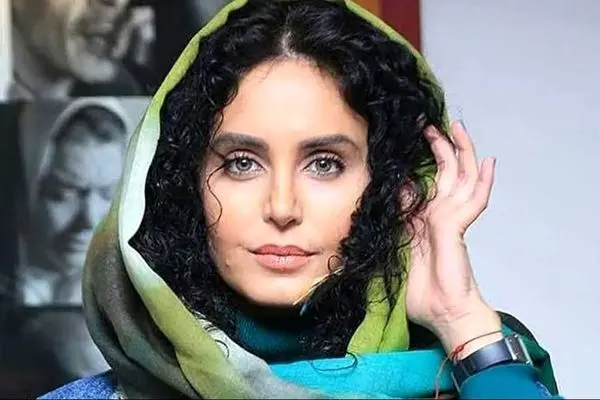 عکس شوکه کننده از الناز شاکردوست در دوران بلوغ / شلخته و بدون عمل زیبایی !