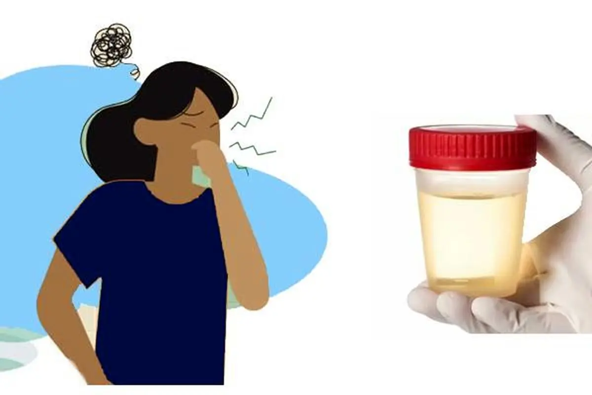 بوی بد ادرار نشانه چیست؟