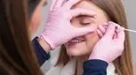 آنچه که باید درباره  بوتاکس ژلی‌ رول بدانید