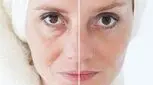 بهترین روش برای جوانسازی صورت