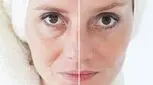 بهترین روش برای جوانسازی صورت