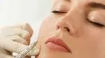 بایو فیلر چیست؟ مزایای بایو فیلر در مقایسه با ژل