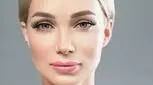بوتاکس چشم گربه ای، محبوب سلبریتی ها