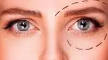 با پلک افتاده چگونه آرایش کنیم؟ 