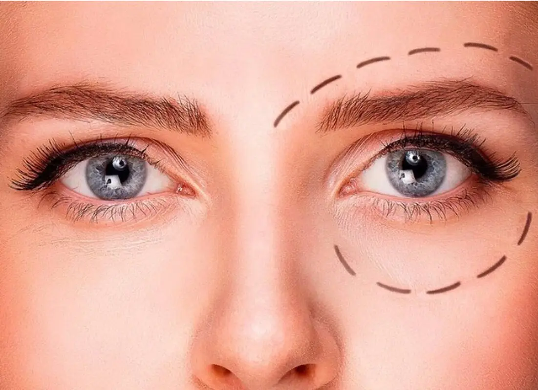 با پلک افتاده چگونه آرایش کنیم؟ 