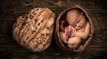 بررسی خواص گردو و پوره آن برای نوزادان زیر یک سال