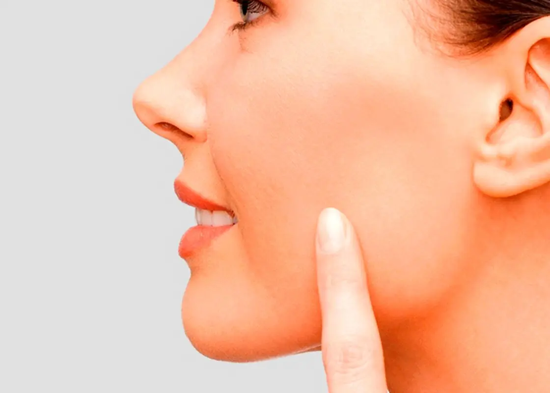 پروتز گونه بهتر است یا تزریق ژل و چربی؟