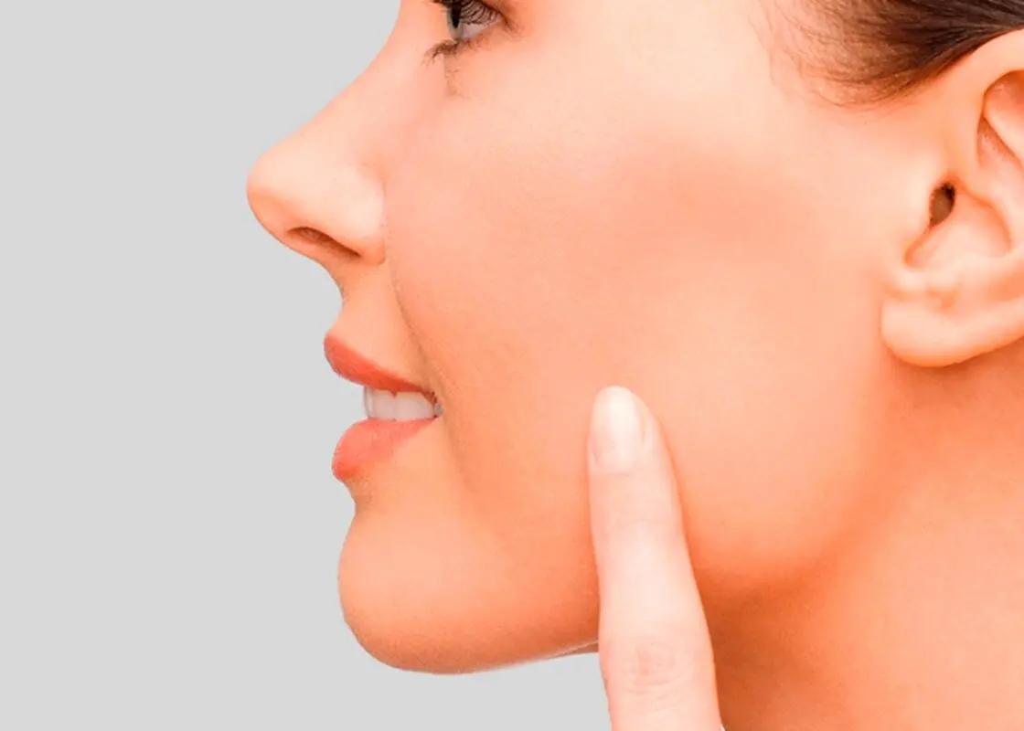 پروتز گونه بهتر است یا تزریق ژل و چربی؟