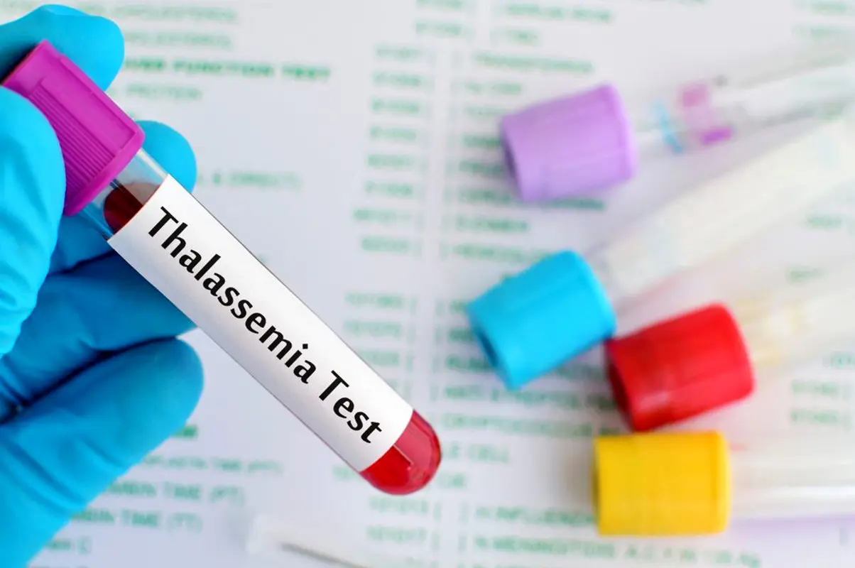 کم خونی مینور والدین/ ویدئو