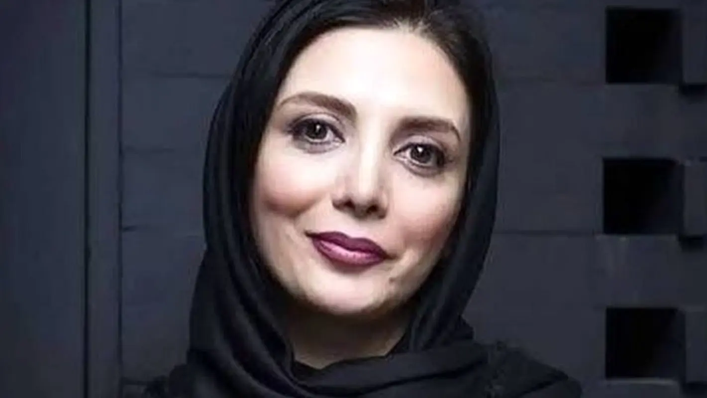 تصاویر لو رفته از تغییر چهره رویا میرعلمی بعد از جراحی!