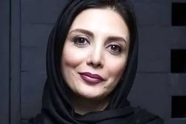 تصاویر لو رفته از تغییر چهره رویا میرعلمی بعد از جراحی!